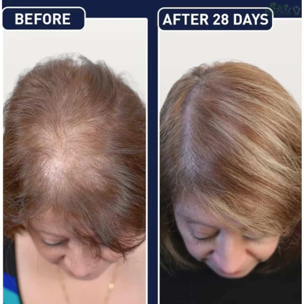 FEG- Hair Growth Spray (Made In USA)